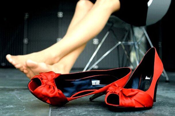 Évitez les talons hauts pour prévenir les varices